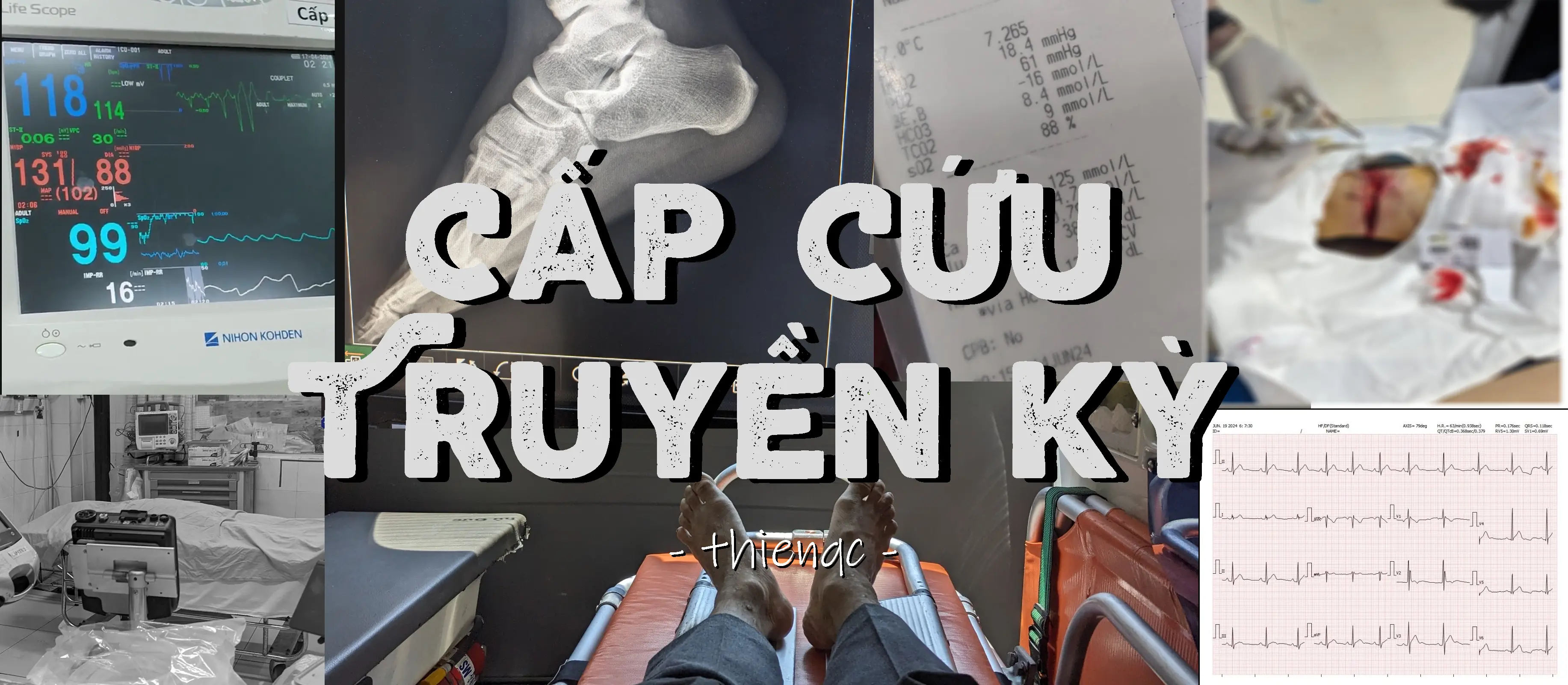 Cấp cứu truyền kì-1786929791181.webp